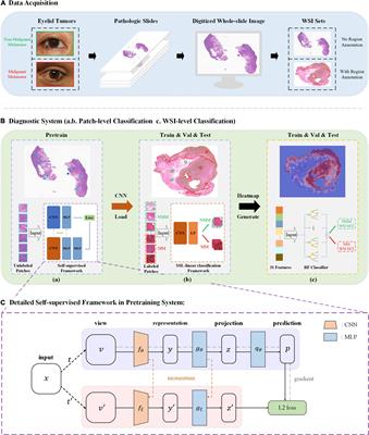 Self-supervised learning mechanism for identification of eyelid malignant melanoma in pathologic slides with limited annotation